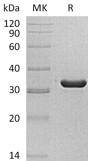 BL-1525NP: Greater than 95% as determined by reducing SDS-PAGE. (QC verified)Recombinant Human SULT1C2 Protein (N-6His)